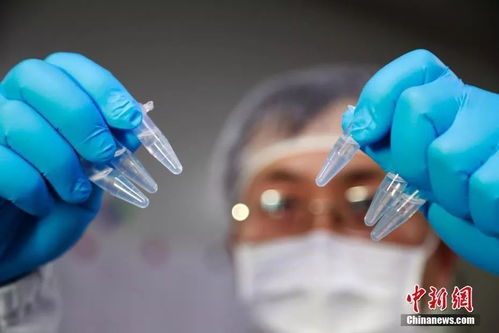 顯微鏡下的新型冠狀病毒 驚人繁衍與生物技術(shù)應(yīng)對(duì)